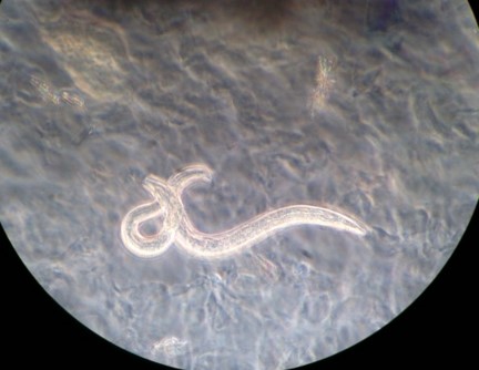 (Fig.2) A desert nematode taken from a plate of agar. Image Credit: Hanna Casares